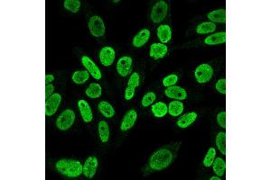 Immunofluorescence Analysis of PFA fixed HeLa cells labeling Cyclin B1 Mouse Monoclonal Antibody (V92. (Cyclin B1 抗体)