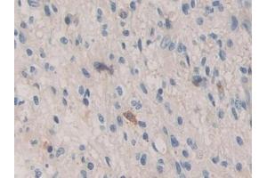 Immunohistochemistry (IHC) image for anti-Bone Morphogenetic Protein 15 (BMP15) (AA 266-388) antibody (ABIN7434677)