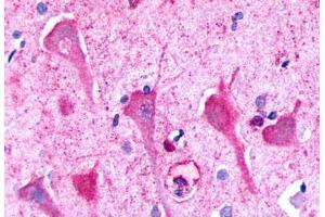 Anti-P2RY8 / P2Y8 antibody  ABIN1049224 IHC staining of human brain, neurons and glia. (P2RY8 抗体  (Cytoplasmic Domain))