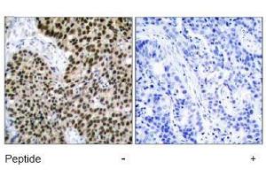 Image no. 2 for anti-Heat Shock Factor Protein 1 (HSF1) (Ser303) antibody (ABIN197514) (HSF1 抗体  (Ser303))