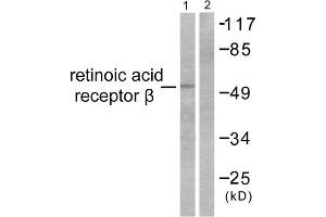 Western Blotting (WB) image for anti-Retinoic Acid Receptor, beta (RARB) (C-Term) antibody (ABIN1848760)