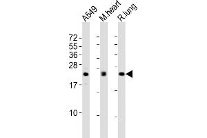 All lanes : Anti-FGF2 Antibody at 1:2000 dilution Lane 1: A549 whole cell lysates Lane 2: mouse heart lysates Lane 3: rat lung lysates Lysates/proteins at 20 μg per lane.