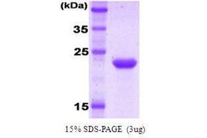 SDS-PAGE (SDS) image for Killer Cell Immunoglobulin-Like Receptor, Two Domains, Long Cytoplasmic Tail, 1 (KIR2DL1) protein (ABIN934897)