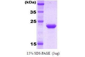 Figure annotation denotes ug of protein loaded and % gel used. (KIR2DL1 蛋白)