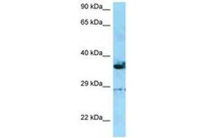 Image no. 1 for anti-Inverted Formin, FH2 and WH2 Domain Containing (INF2) (C-Term) antibody (ABIN6748410) (INF2 抗体  (C-Term))