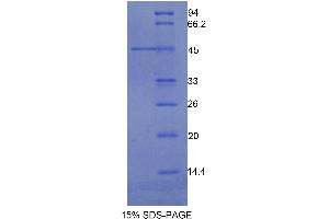 SDS-PAGE analysis of Human Integrin alpha M (ITGAM) Protein. (CD11b 蛋白)