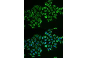 Immunofluorescence analysis of MCF-7 cells using RHOD antibody (ABIN6131344, ABIN6146938, ABIN6146939 and ABIN6222119). (RHOD 抗体  (AA 1-210))
