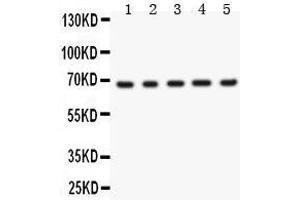 Anti- Menin Picoband antibody, Western blotting All lanes: Anti Menin  at 0. (Menin 抗体  (AA 301-615))