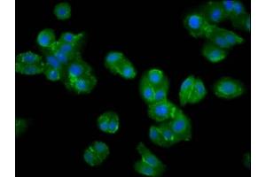 Immunofluorescence staining of HepG2 cells with ABIN7169218 at 1:200, counter-stained with DAPI. (VRK2 抗体  (AA 317-472))
