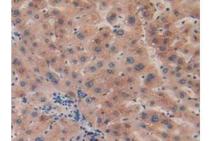 IHC-P analysis of Human Liver Tissue, with DAB staining. (CPB2 抗体  (AA 138-423))