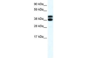 RFP2 antibody used at 2. (TRIM13 抗体  (Middle Region))