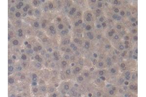 Immunohistochemistry (IHC) image for anti-Interleukin 33 (IL33) (AA 110-261) antibody (ABIN7427711)