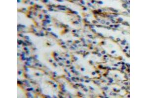 Used in DAB staining on fromalin fixed paraffin-embedded Spleen tissue (SIGLEC5 抗体  (AA 18-135))