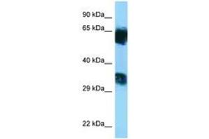 Image no. 1 for anti-Mannosyl (Alpha-1,6-)-Glycoprotein beta-1,6-N-Acetyl-Glucosaminyltransferase, Isozyme B (MGAT5B) (AA 362-411) antibody (ABIN6748202) (MGAT5B 抗体  (AA 362-411))