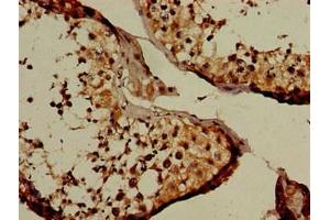 Immunohistochemistry of paraffin-embedded human testis tissue using ABIN7161815 at dilution of 1:100 (NUP107 抗体  (AA 1-66))