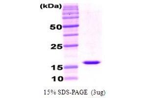 Figure annotation denotes ug of protein loaded and % gel used. (Adiponectin (ADIPOQ) (AA 111-247), (Globular Domain) Peptide)