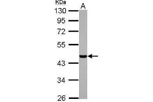 Western Blotting (WB) image for anti-Casein Kinase 1, alpha 1-Like (CSNK1A1L) antibody (ABIN2856129)