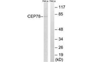 Western blot analysis of extracts from HeLa cells, using CEP78 Antibody. (CEP78 抗体  (AA 301-350))