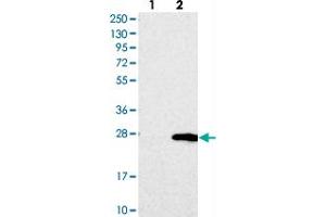 Western blot analysis of Lane 1: Negative control (vector only transfected HEK293T lysate), Lane 2: Over-expression Lysate (Co-expressed with a C-terminal myc-DDK tag (~3. (TMEM204 抗体)
