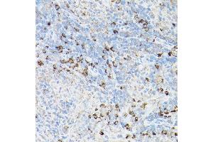 Immunohistochemistry of paraffin-embedded rat spleen using Fas Rabbit pAb (ABIN1683066, ABIN1683065, ABIN5664115 and ABIN6219731) at dilution of 1:100 (40x lens). (FAS 抗体  (AA 61-335))