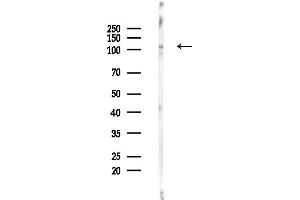 Western blot analysis of lysates from Hela cells(UV,30 min treatment), using KSR1 Antibody at 1/1000 dilution.