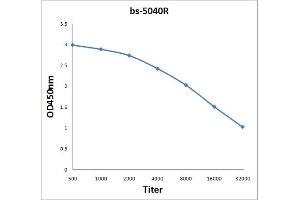 Antigen: 2 µg/100 µL  Primary: Antiserum, 1:500, 1:1000, 1:2000, 1:4000, 1:8000, 1:16000, 1:32000;  Secondary: HRP conjugated Rabbit Anti-Goat IgG at 1: 5000;  TMB staining Read the data in Microplate Reader by 450nm. (BAAT 抗体  (AA 101-200))