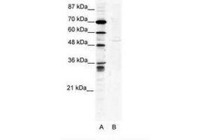 Image no. 1 for anti-Zinc Finger Protein 134 (ZNF134) (AA 93-142) antibody (ABIN202498) (ZNF134 抗体  (AA 93-142))