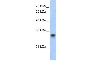 WB Suggested Anti-RPL8 Antibody Titration:  0. (RPL8 抗体  (C-Term))