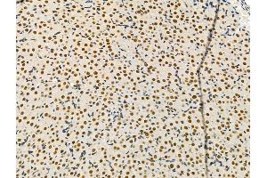 ABIN6263384 and ABIN6276526 at 1/100 staining Rat ovarian tissue by IHC-P.