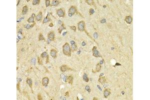 Immunohistochemistry of paraffin-embedded Rat brain using IL10RA Polyclonal Antibody at dilution of 1:200 (40x lens). (IL-10RA 抗体)
