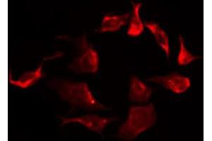 ABIN6267266 staining SK-OV3 by IF/ICC. (EGFR 抗体  (pTyr869))