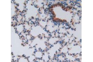 IHC-P analysis of Mouse Lung Tissue, with DAB staining. (HEXB 抗体  (AA 101-217))