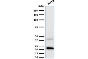 Formalin-fixed, paraffin-embedded human Pancreas stained with Ferritin, Light Chain Mouse Monoclonal Antibody (FTL/1389). (FTL 抗体  (AA 38-165))