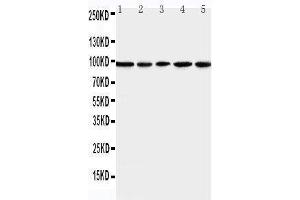 Anti-MCM6 antibody, Western blotting Lane 1: U87 Cell Lysate Lane 2: COLO320 Cell Lysate Lane 3: HELA Cell Lysate Lane 4: MCF-7 Cell Lysate Lane 5: JURKAT Cell Lysate