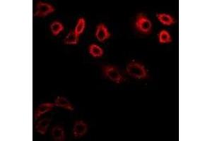 Immunofluorescent analysis of CDK6 staining in K562 cells. (CDK6 抗体)
