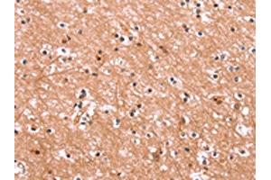 The image on the left is immunohistochemistry of paraffin-embedded Human brain tissue using ABIN7190562(ENPP4 Antibody) at dilution 1/15, on the right is treated with synthetic peptide. (ENPP4 抗体)