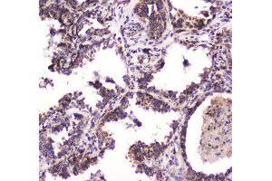 IHC analysis of BRD7 using anti-BRD7 antibody . (BRD7 抗体  (AA 514-567))