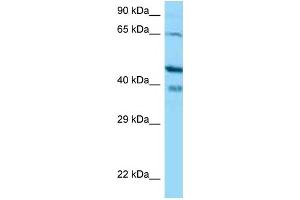 Western Blotting (WB) image for anti-Calcium Binding Protein 1 (CABP1) (N-Term) antibody (ABIN2774384) (CABP1 抗体  (N-Term))