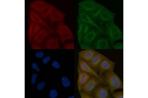 PDGF Receptor beta Mouse Monoclonal Antibody staining Hela cells by IF/ICC.