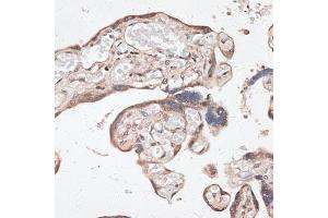 Immunohistochemistry of paraffin-embedded human placenta using SPDEF antibody (ABIN6132572, ABIN6148332, ABIN6148334 and ABIN6218364) at dilution of 1:100 (40x lens). (SPDEF/PSE 抗体  (AA 1-335))