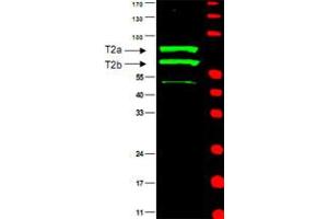 Western blot using CCNT2 polyclonal antibody  is shown to detect two major bands (arrowheads) corresponding to human CCN T2a and T2b as indicated. (Cyclin T2 抗体)
