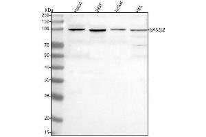 Western blot analysis of GAS2L2 using anti-GAS2L2 antibody (ABIN7601727).