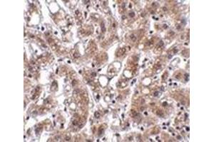 Immunohistochemistry of THEM4 in human liver tissue with this product at 2. (THEM4 抗体  (Center))