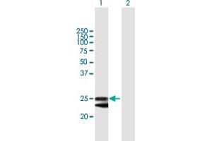 Western Blot analysis of FKBP14 expression in transfected 293T cell line by FKBP14 MaxPab polyclonal antibody. (FKBP14 抗体  (AA 1-211))