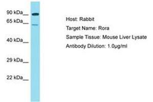 Image no. 1 for anti-RAR-Related Orphan Receptor A (RORA) (AA 201-250) antibody (ABIN6750242) (RORA 抗体  (AA 201-250))
