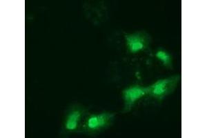 Anti-SPR mouse monoclonal antibody (ABIN2453682) immunofluorescent staining of COS7 cells transiently transfected by pCMV6-ENTRY SPR (RC205679). (SPR 抗体)