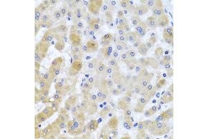 Immunohistochemistry of paraffin-embedded human liver injury using EIF3M antibody at dilution of 1:100 (x40 lens). (Eukaryotic Translation Initiation Factor 3, Subunit M (EIF3M) 抗体)