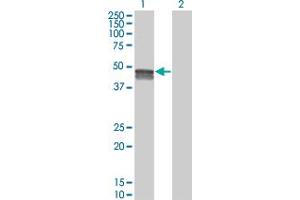 Western Blot analysis of SMPDL3B expression in transfected 293T cell line by SMPDL3B monoclonal antibody (M01), clone 5E12. (SMPDL3B 抗体  (AA 274-372))