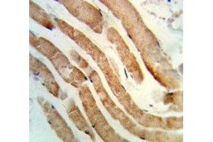 IHC analysis of FFPE human skeletal muscle stained with RAB7 antibody (RAB7A 抗体  (AA 176-204))