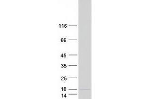 Western Blotting (WB) image for Calcium/calmodulin-Dependent Protein Kinase II Inhibitor 2 (CAMK2N2) protein (Myc-DYKDDDDK Tag) (ABIN2713094)